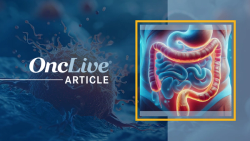 GPC3 Offers Highly Specific Target in HCC