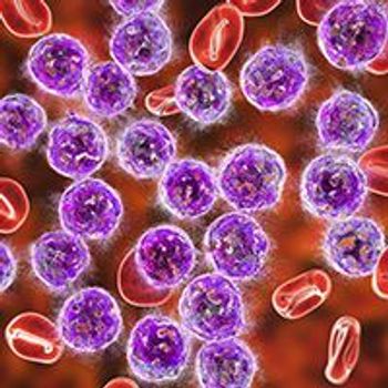 Mantle Cell Lymphoma