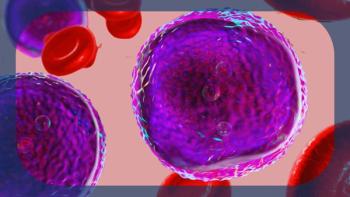 Higher-Risk MDS | Image credit:   © Motion Pics - stock.adobe.com