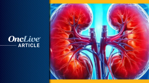 RCC | Image Credit: © Ashling Wahner & MJH Life Sciences Using AI
