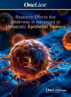 Research Efforts Are Underway in Advanced or Metastatic Epithelial Tumors