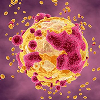 Undifferentiated Pleomorphic Sarcoma