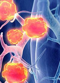 Ivonescimab Wins NMPA Approval in China for First-Line, PD-L1+ Advanced ...