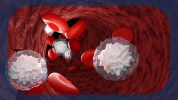 Myelofibrosis | Image credit:  © Om.Nom.Nom - stock.adobe.com