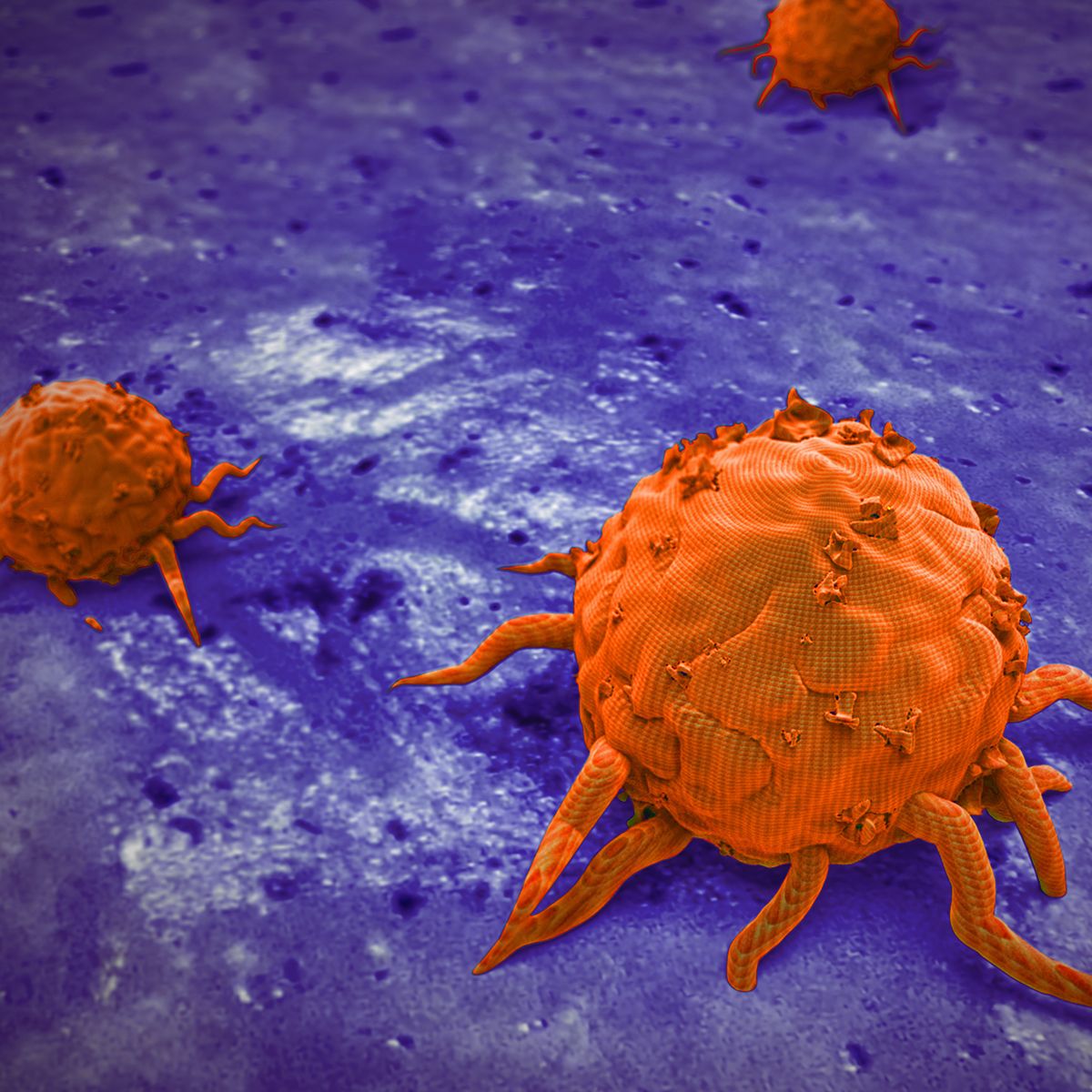solid tumor cancer cells 