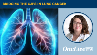 Bridging the Gaps in Lung Cancer | Image Credit: © Ashling Wahner & MJH Life Sciences Using AI