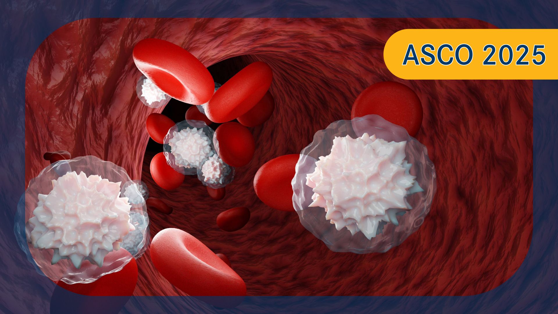 Multiple Myeloma | Image  Credit: © Om.Nom.Nom - stock.adobe.com