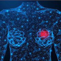 Breast Cancer - stock.adobe.com