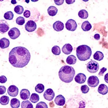 Tocilizumab and Step-Up Teclistamab Dosing in R/R MM  © David A Litman - stock.adobe.com