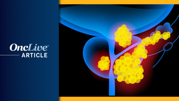 Prostate Cancer | Image Credit: © pikovit - stock.adobe.com