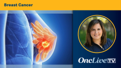 Mabel Mardones, MD, discusses how Dato-DXd and sacituzumab govitecan may affect first-line treatment for metastatic triple-negative breast cancer.