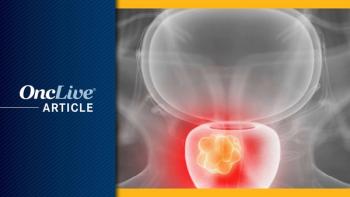 Prostate Cancer | Image Credit: © Sebastian Kaulitzki - stock.adobe.com