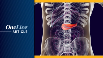 Pancreatic Cancer | © canva.com
