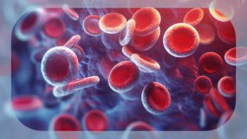 UM171 Cell Therapy for Hematologic Malignancies | Image Credit: © Oleksandr - stock.adobe.com