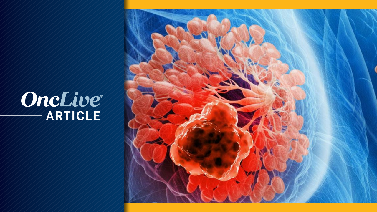 Early-Stage Breast Cancer  | Image Credit: © Sebastian Kaulitzki - stock.adobe.com
