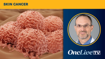 Vernon Sondak, MD