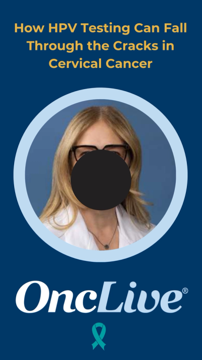 How HPV Testing Can Fall Through the Cracks in Cervical Cancer