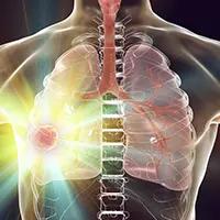 Amivantamab in NSCLC | Image Credit: © Dr_Microbe - stock.adobe.com