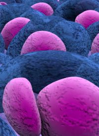 Multiple Myeloma | Image Credit: © LASZLO - stock.adobe.com