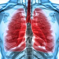 Lung Cancer: ©  stock.adobe.com