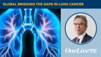 Global Bridging the Gaps in Lung Cancer | Image Credit: © Ashling Wahner & MJH Life Sciences Using AI