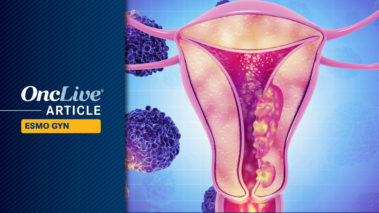 Circulating Immune Protein Signature Is Validated as OS Prognostic Tool in Recurrent Ovarian Cancer