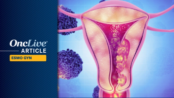 Ovarian Cancer | Image Credit: © freshidea - stock.adobe.com