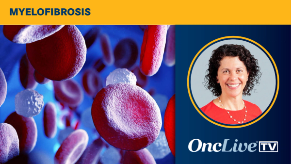 Gabriela S. Hobbs, MD, discusses how to distinguish proliferative from cytopenic myelofibrosis and the role of risk stratification
