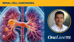 Dr Pal on the Rationale for Evaluating Atezolizumab in High-Risk Localized RCC