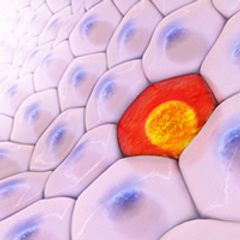 EP. 1 KRd Improves PFS as Maintenance Therapy in Transplant-Eligible Multiple Myeloma