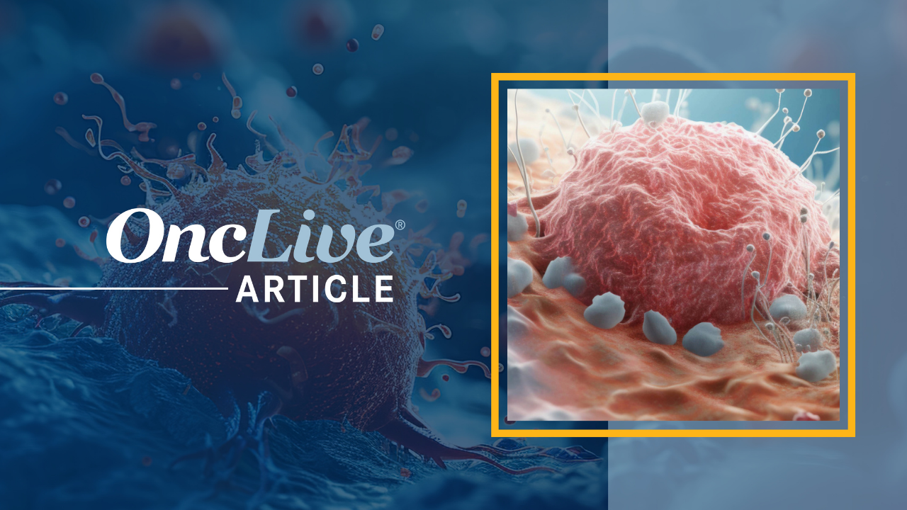 Locally Advanced Melanoma | Image credit:  © Maris - stock.adobe.com