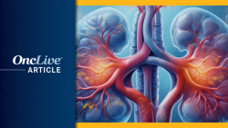 Belzutifan-Based Combinations Meet DFS, PFS End Points in Renal Cell Carcinoma