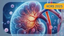 A Novel CAR T-Cell Therapy Could Pave the Way for Improvements in Advanced ccRCC Management