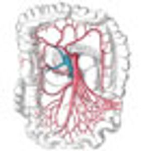 Number of Lymph Nodes Examined for Colon Cancer Increases but Proportion of Node-Positive Cancers Does Not