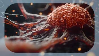 Advanced Melanoma | Image credit:  © Pter - stock.adobe.com