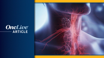 HNSCC | Image Credit: © Creative Station - stock.adobe.com