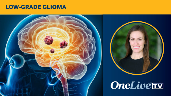 Pediatric Low-Grade Glioma | Image Credit: © Matthieu - stock.adobe.com