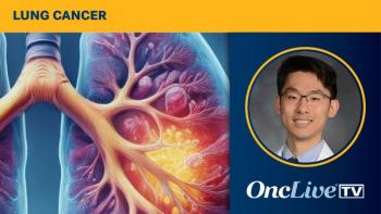 Lung cancer | Image Credit: © Image by Ashling Wahner & MJH Life Sciences Using AI