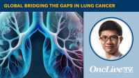 Global Bridging the Gaps in Lung Cancer | Image Credit: © Ashling Wahner & MJH Life Sciences Using AI