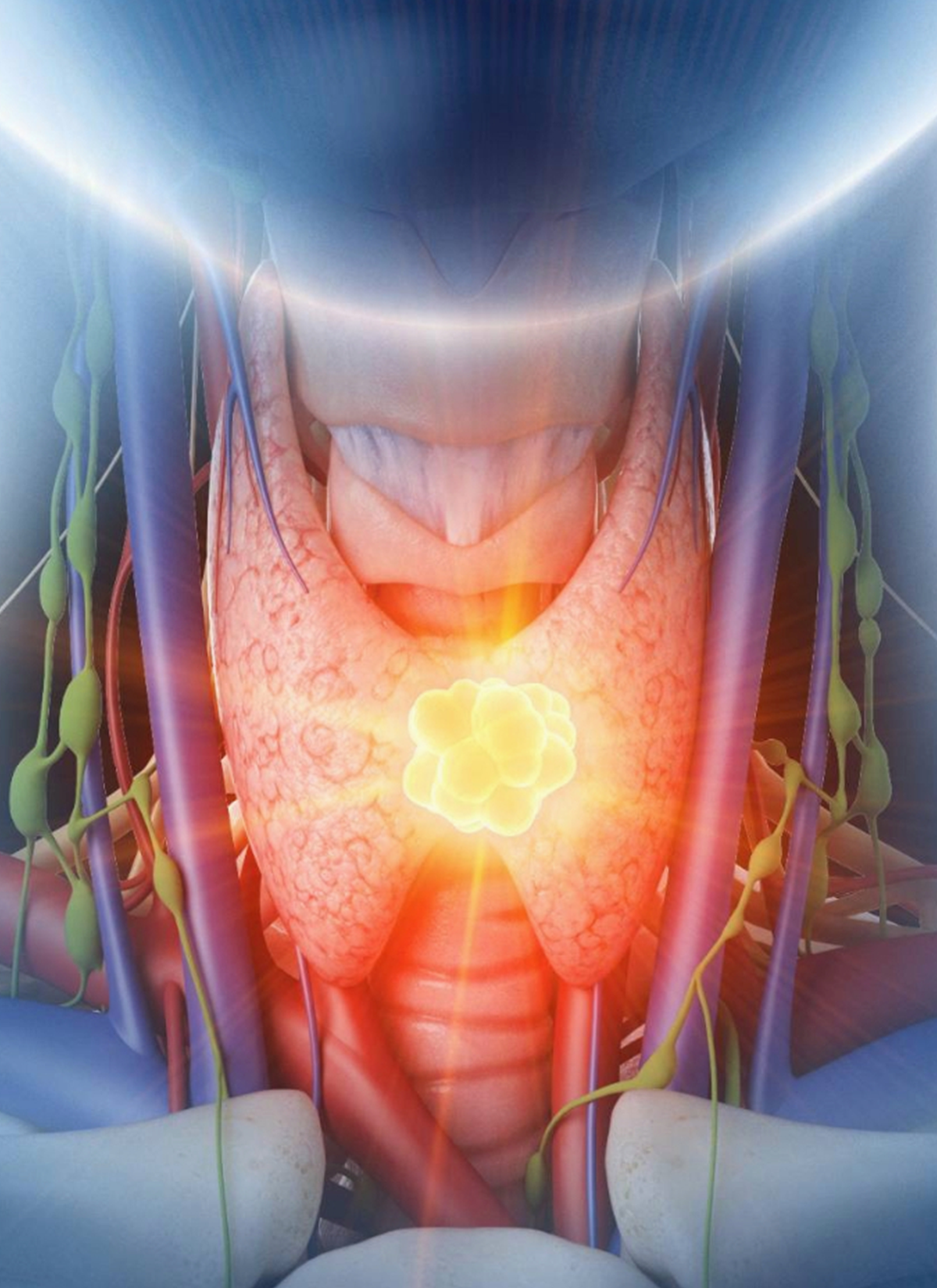 Toripalimab Becomes First Approved Immunotherapy for Recurrent  Unresectable/Metastatic NPC in Canada | OncLive