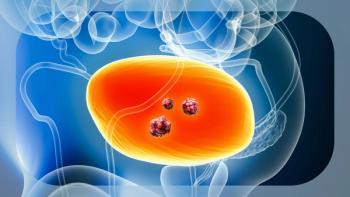 Urothelial Cancer | Image credit: © Matthieu - stock.adobe.com