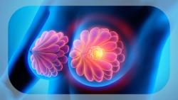 KAT6 Inhibition Shows Path to Overcoming Resistance Mechanisms in ER+ Breast Cancer