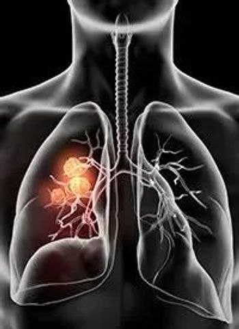 Small Cell Lung Cancer