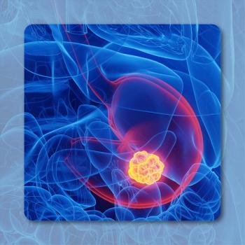 Gastrointestinal Cancer |  Image credit: © Sebastian Kaulitzki  – stock.adobe.com