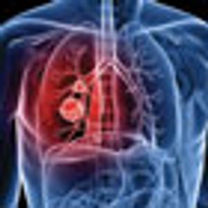 Advances in Immunotherapy for the Treatment of Non-Small Cell Lung Cancer