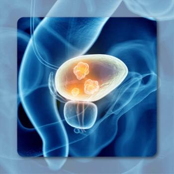 Bladder Cancer | Image Credit: © Sebastian Kaulitzki – stock.adobe.com