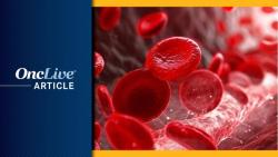 Meta Analysis Highlights Benefits of JAK Inhibitors vs BAT in Myelofibrosis