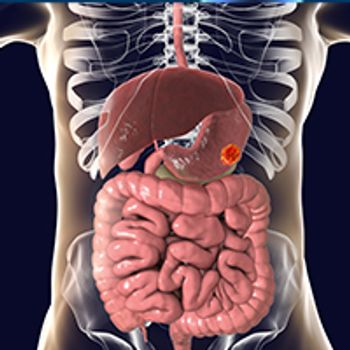 esophageal squamous cell carcinoma