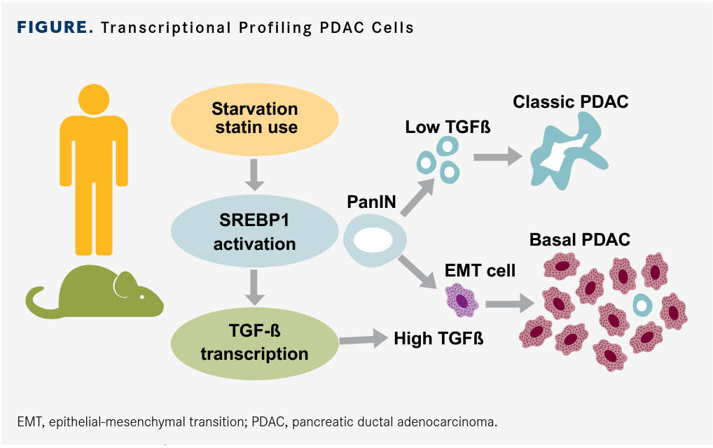 Findings Suggest Cholesterol Plays A Surprising Role In Pancreatic Cancer Findings Suggest Cholesterol Plays A Surprising Role In Pancreatic Cancer