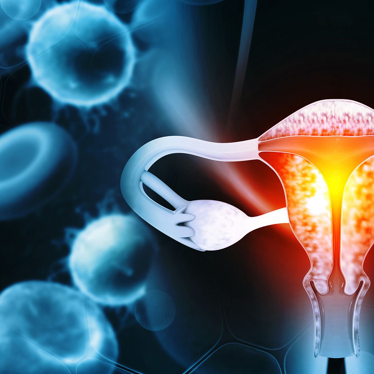 Endometrial Cancer | Image Credit: © Crystal light - stock.adobe.com